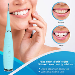 Electric Dental Calculus Remover - Sonic Tooth Tartar Plaque Removal Kit - Safe Stain Cleaner for Kids & Adults (Multi)
